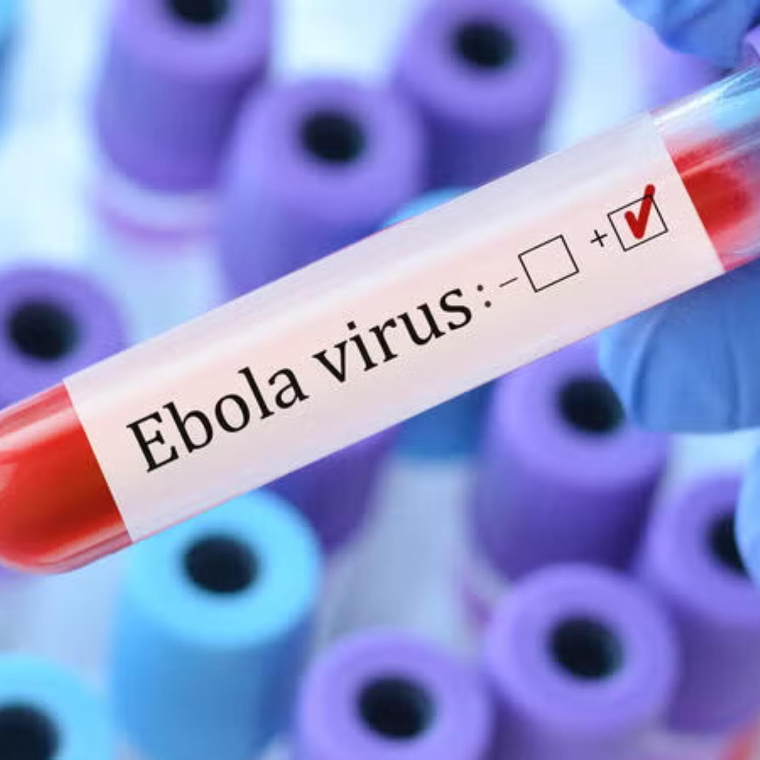 Ministry of Health continues to strengthen its National Ebola Virus Disease Plan episode artwork