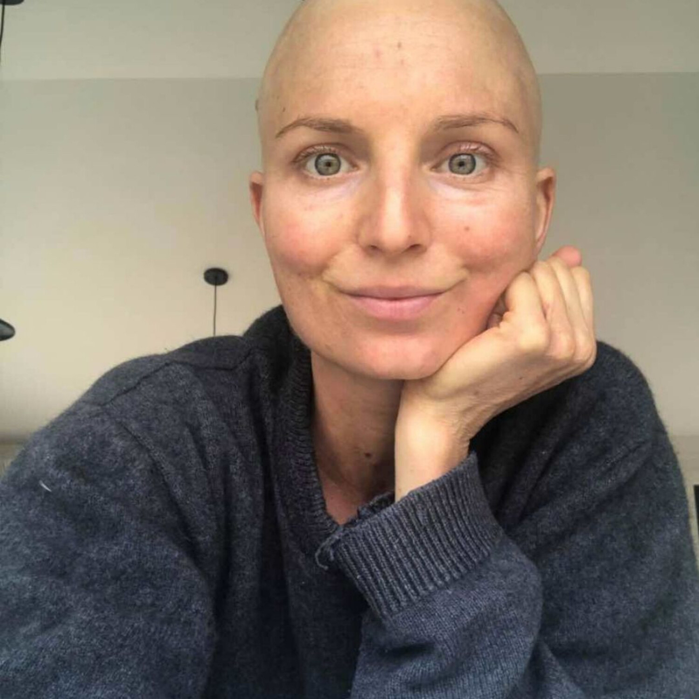 Pain Story: Kate Callaghan - The emotions behind by Stage ...