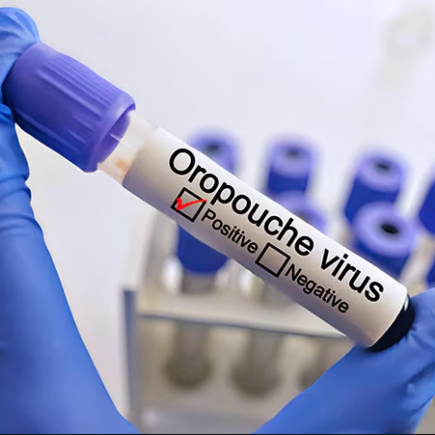 Ministry of Health Alerts Public to Confirmed Oropouche Virus Cases in Barbados